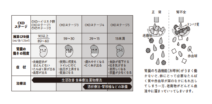 腎臓病のステージ